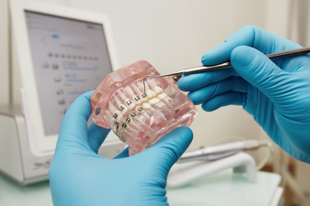 Invisalign vs Brackets ¿Cuál es la mejor opción para tu ortodoncia?
